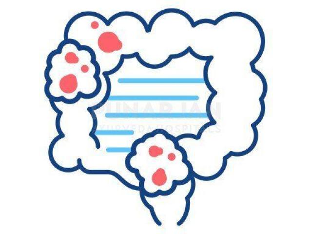 Best Colon/colorectal Cancer Treatment Hospitals in Chennai