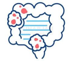 Best Colon/colorectal Cancer Treatment Hospitals in Chennai