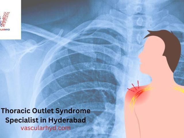Thoracic Outlet Syndrome Specialist in Hyderabad | Vascularhyd