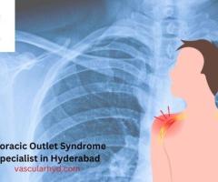Thoracic Outlet Syndrome Specialist in Hyderabad | Vascularhyd