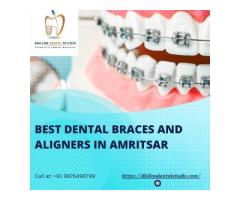 Best Dental Braces and Aligners in Amritsar | Dhillon Dental Studio