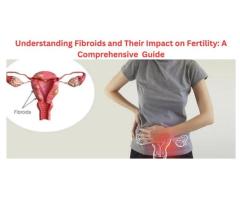 Detailed Information on Fibroids and Their Impact on Fertility