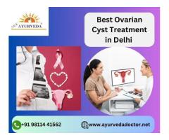 Best Ovarian Cyst Treatment in Delhi | SKK Ayurveda