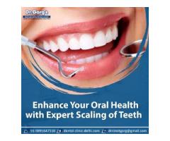 Enhance Your Oral Health with Expert Scaling of Teeth