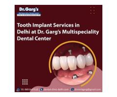 Tooth Implant Services in Delhi at Dr. Garg’s Multispeciality Dental Center